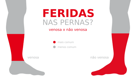 Infográfico sobre úlcera arterial – ferida difícil de cicatrizar | Cicatriza
